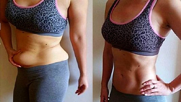Home Remedies to Lose Weight on Tummy and Hips Home Remedies to Lose Weight on Tummy and Hips
